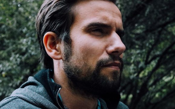 Saç Ekimi hakkında bazı bilgiler Saç Ekimi hakkında bazı bilgiler