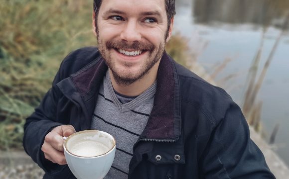 FUE yönteminin özellikleri FUE yönteminin özellikleri