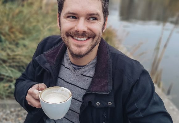 FUE yönteminin özellikleri