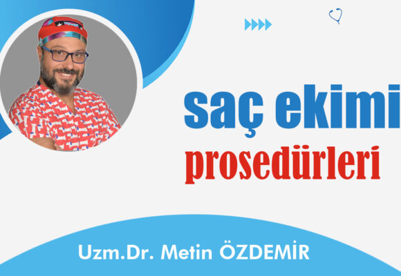 Saç Ekimi Prosedürleri