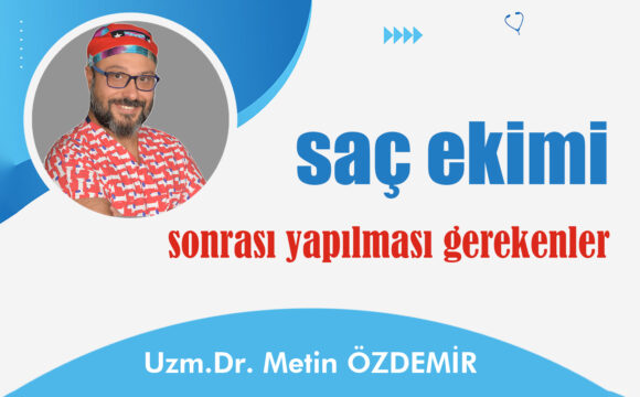 Saç Ekimi Sonrası Yapılması Gerekenler Saç Ekimi Sonrası Yapılması Gerekenler